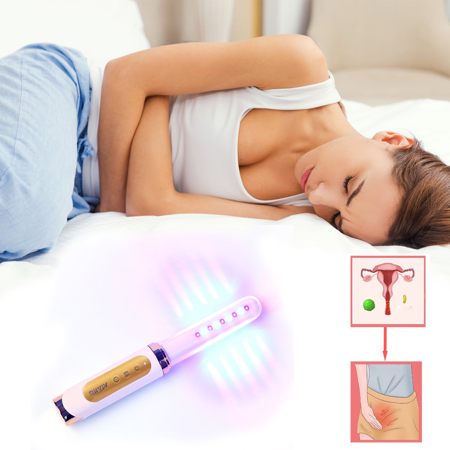 Vaginal Laser Therapy for Gynecologic conditions